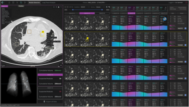 contextflow integriert weitere Features in ADVANCE Chest CT