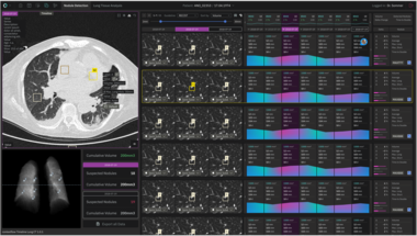 contextflow_ADVANCE Chest CT_TIMELINE UI(1).png