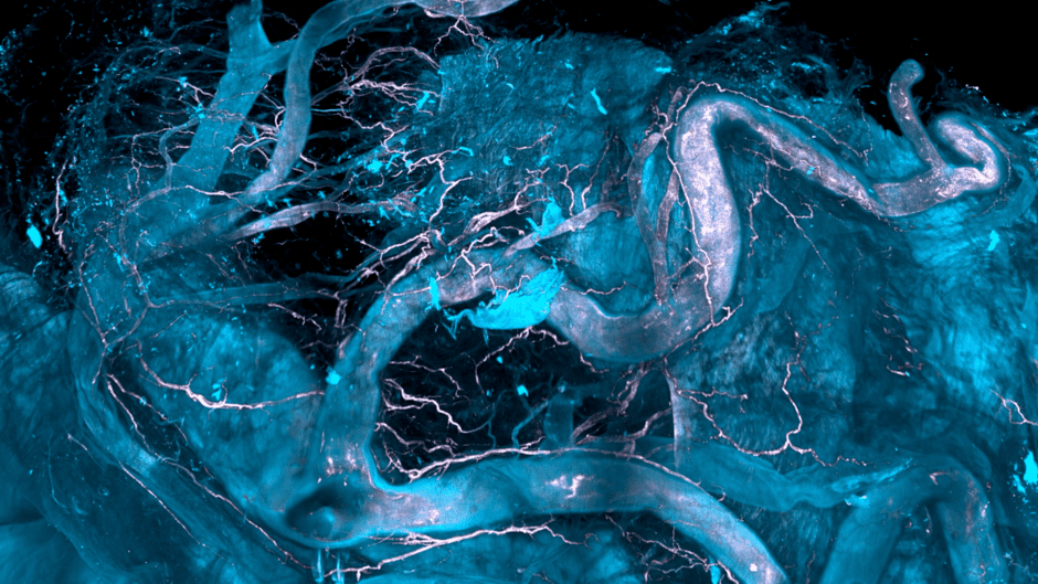 Neue 3D-Spatial-Omics-Technologie ermöglicht die Untersuchung von Krankheiten in ihren frühen Stadien