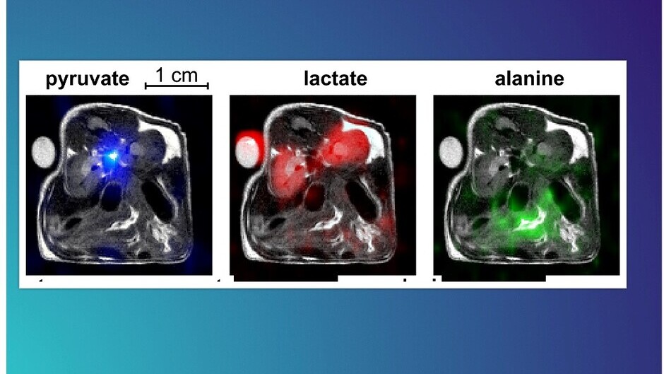 Bedeutender Fortschritt für neue Bildgebung in der Krebsdiagnostik