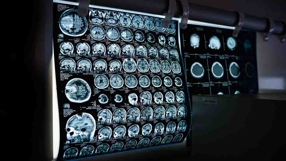 Künstliche Intelligenz hilft bei Diagnose und Behandlung von MRT-Patient:innen