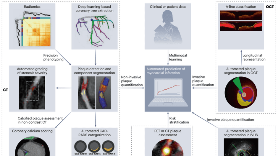 anwendungen-zur-plaque-diagnose-und-prognose-in-der-koronaren-bildgebung (1) (1) (1).png