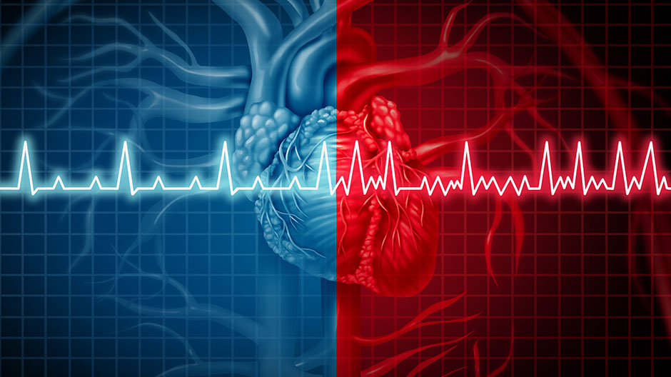 Vorhofflimmer-Ablation: Erfolg mit KI besser vorhersagbar?