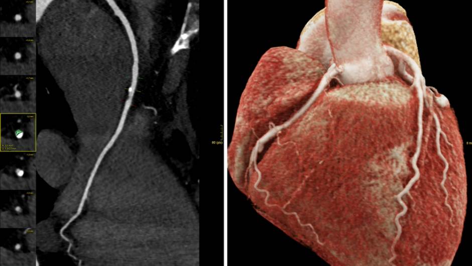 Hochmoderne und präzise Diagnostik dank neuem CT-Gerät