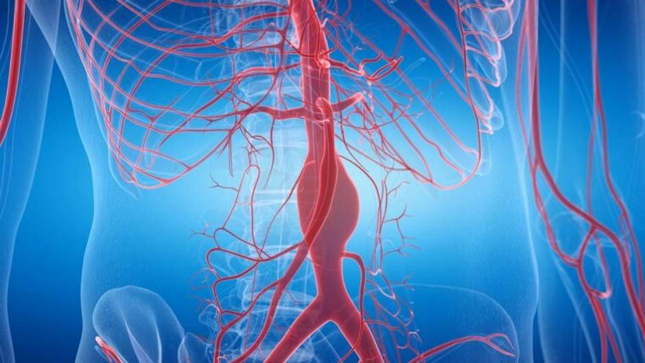 Bauchaortenaneurysma: Lebensgefahr im Bauch – Ultraschall-Screening bleibt untergenutzt