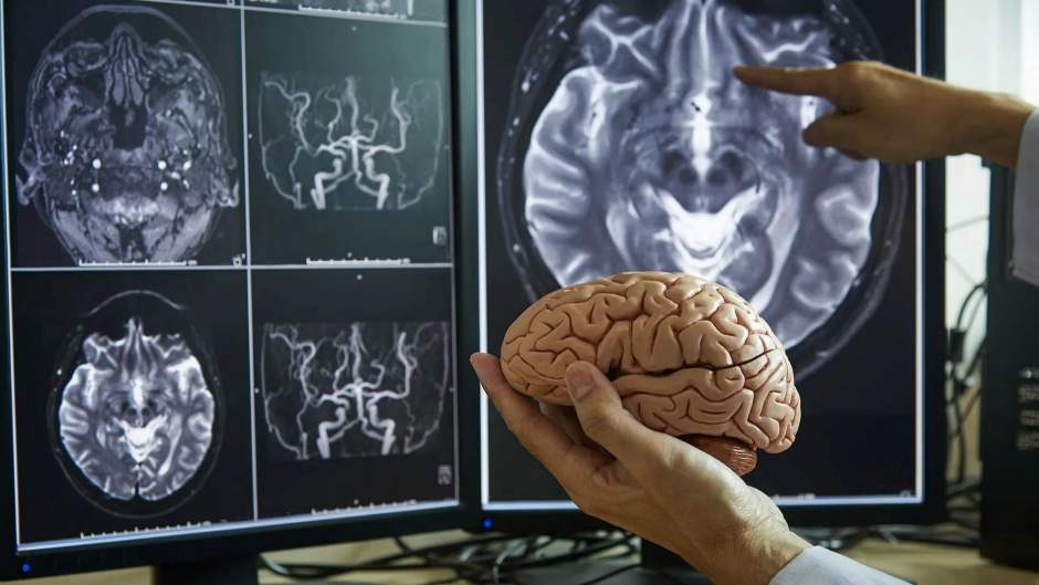 Hirnscan als BMI-Orakel für psychisch kranke Menschen