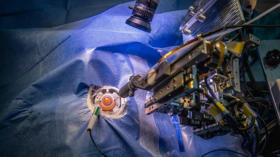 Robotik in der Augenheilkunde: Neuer TUM-OP-Assistent revolutioniert Behandlung der Makuladegeneration