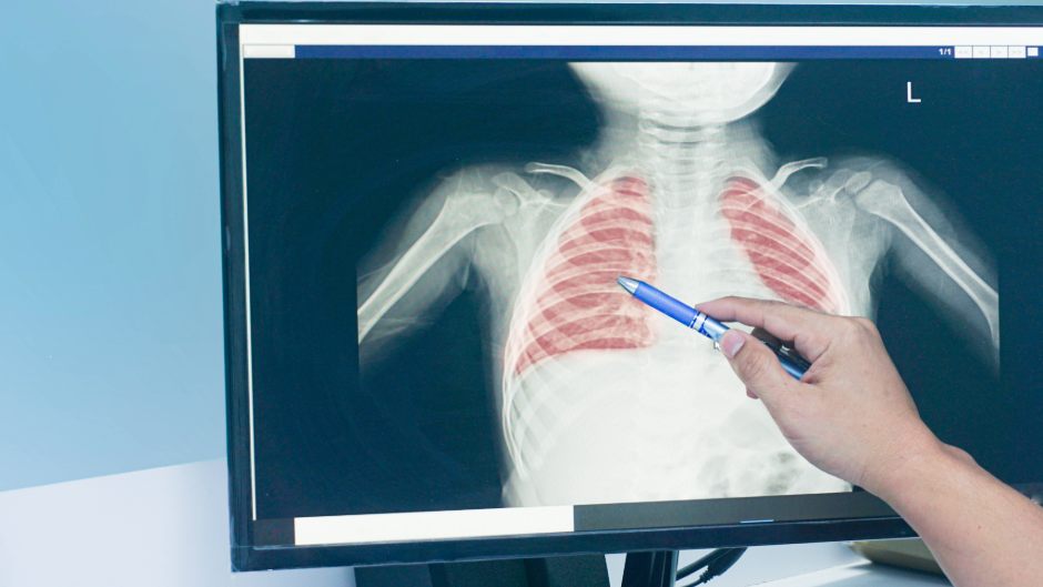 Krankenhausreform ohne Kinderradiologie? Die Jüngsten dürfen nicht durchs Raster fallen! Krankenhausreform ohne Kinderradiologie? Die Jüngsten dürfen nicht durchs Raster fallen!