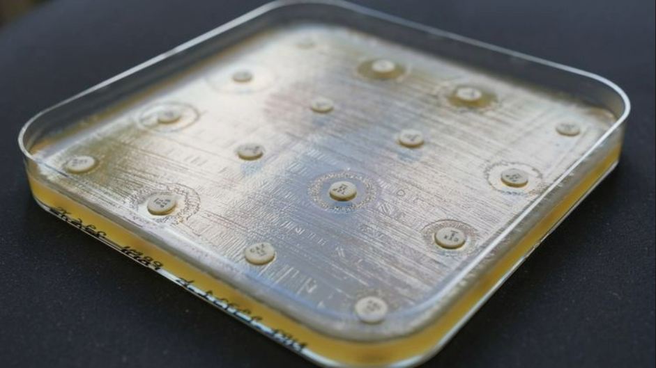 KI-Modell „CarbaDetector“ verbessert Erkennung gefährlicher Antibiotikaresistenzen deutlich