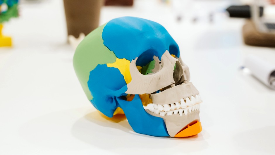 Vom 3D-Scan zur Prothese: Wie das Radboud UMC Patienten in der Ukraine versorgt Vom 3D-Scan zur Prothese: Wie das Radboud UMC Patienten in der Ukraine versorgt