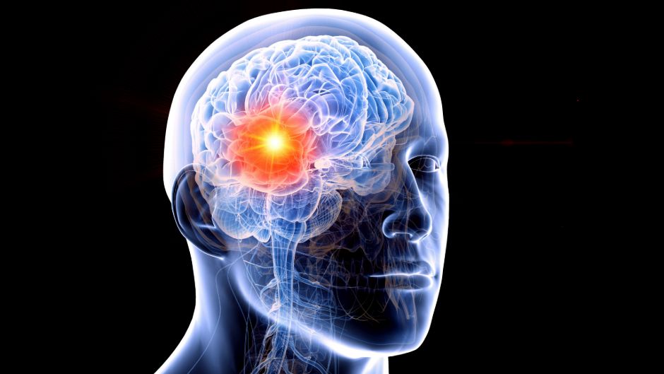 KI-gestützte molekulare Krebsdiagnose bei Hirntumoren