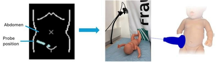 Tiefenkamera automatisiert Ultraschalldokumentation