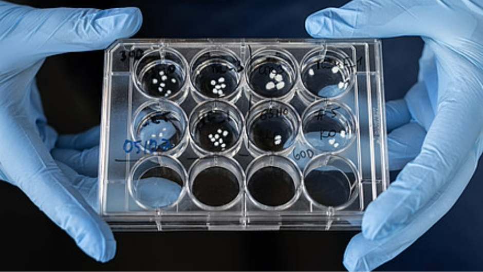 Einstein Center for Early Disease Interception eröffnet