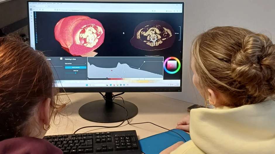„Inside Insight“: Hochschule Bremerhaven entwickelt neue Ansätze für datenbasierte Einblicke im Gesundheitsbereich