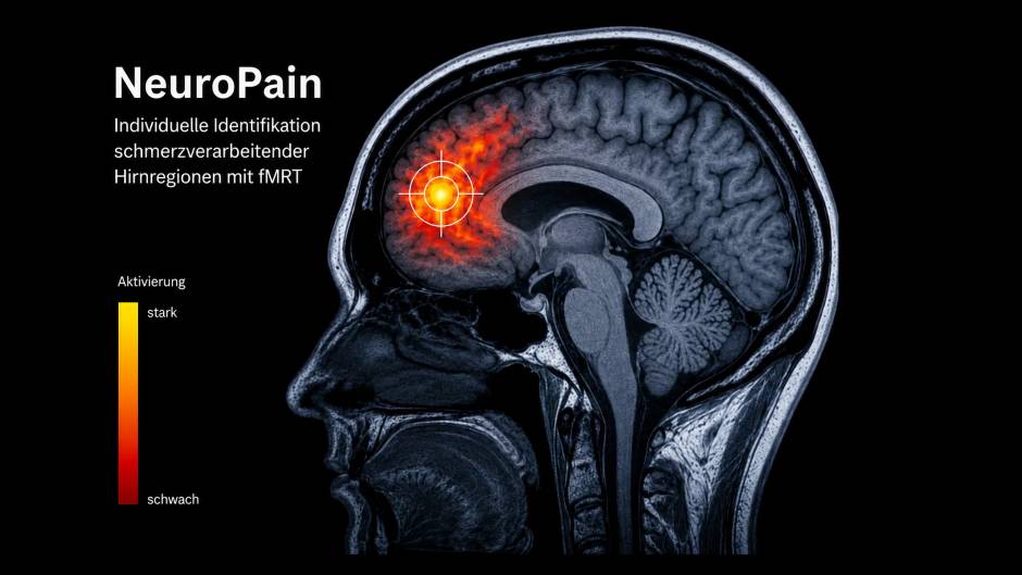 NeuroPain: LMU erforscht personalisierte Ultraschalltherapie gegen chronische Rückenschmerzen
