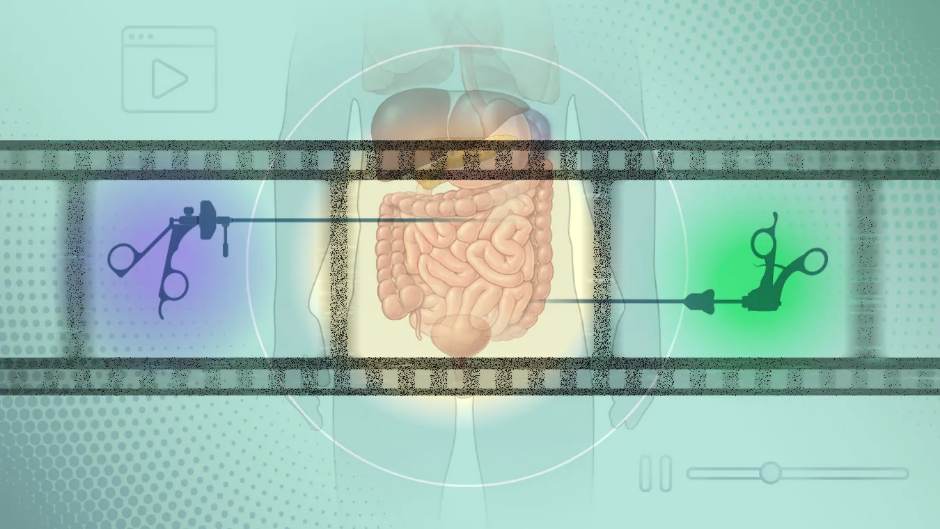 Datensichere Videoanalyse verbessert chirurgische KI