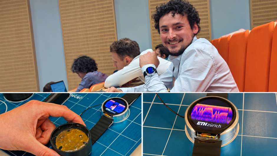 WatchUS macht Ultraschall am Handgelenk tragbar