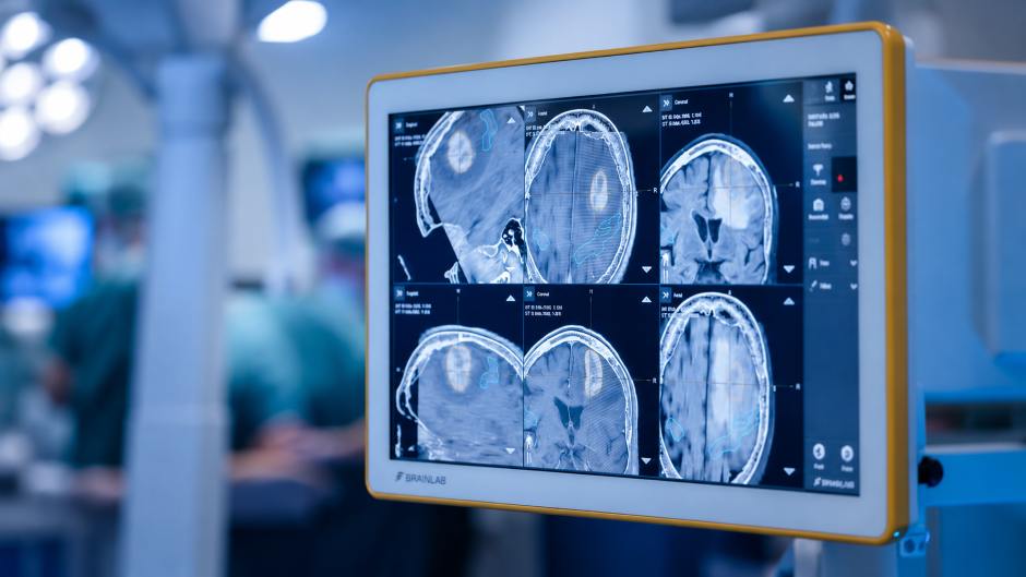Föderiertes Lernen ermöglicht datenschutzfreundliche KI für die Strahlentherapie