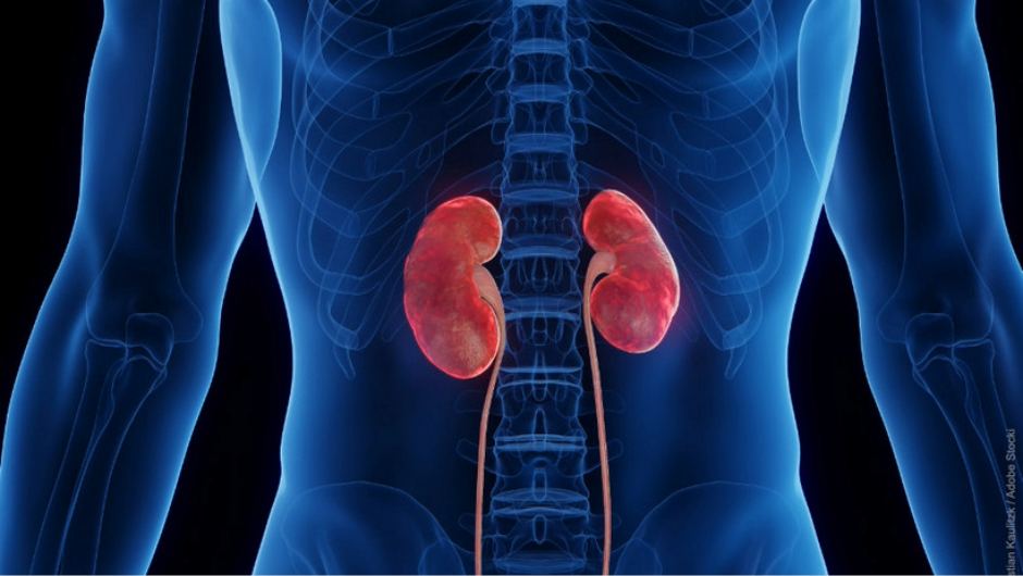 MEDA-PKD vernetzt medizinische Daten für Forschung und Versorgung